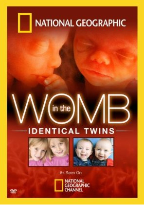 In the womb: Identical twins - NATIONAL GEOGRAPHIC