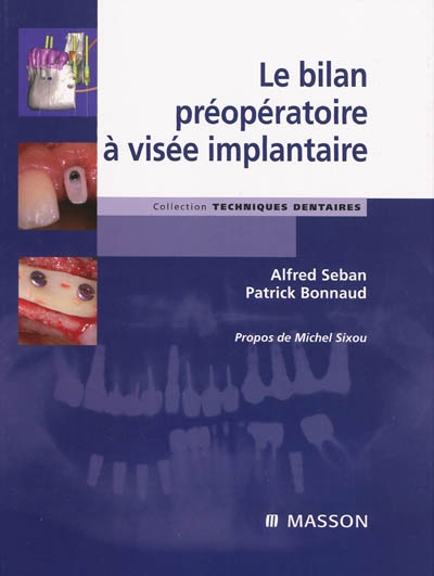 Bilan préopératoire à visée implantaire - ALFRED SEBAN - PATRICK BONNAUD