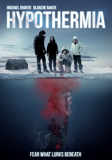 Hypothermia - JAMES FELIX MCKENNEY