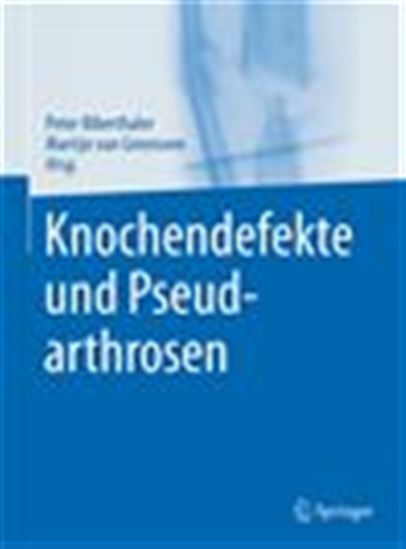 Knochendefekte und Pseudarthrosen - PETER BIBERTHALER - MART VAN GRIENSVEN