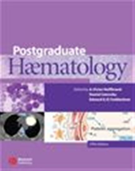 Postgraduate Haematology - DANIEL CATOVSKY - A. VICTOR HOFFBRAND - 
