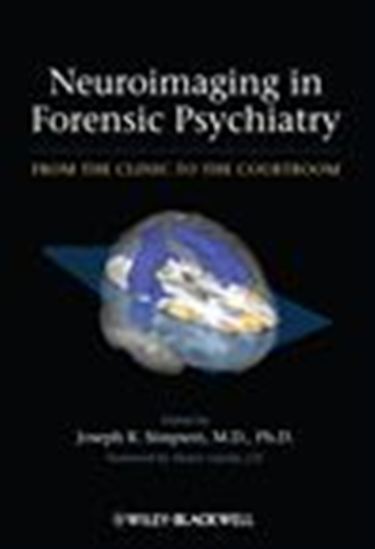 Neuroimaging in Forensic Psychiatry - JOSEPH R. SIMPSON