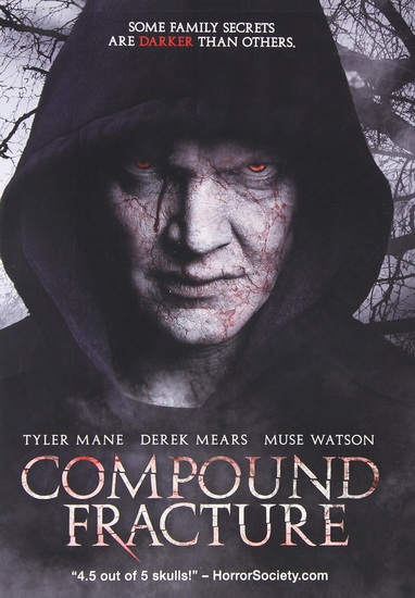 Compound Fracture - RICKERT-EPSTEIN ANTHONY J.
