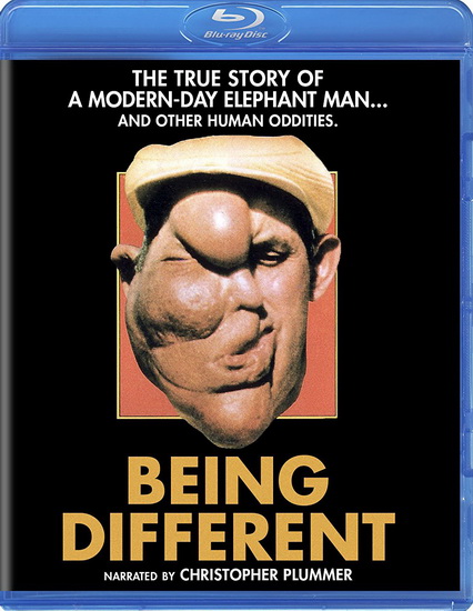 Being Different (1981) (Blu-Ray) - RASKY HARRY