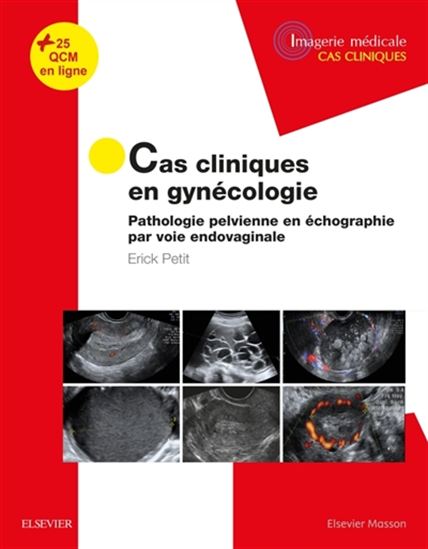 Cas cliniques en gynécologie : pathologie pelvienne en échographie par voie endovaginale - ERICK PETIT