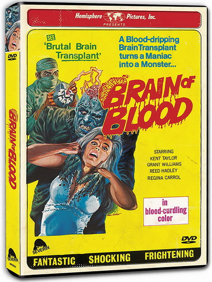 Brain of Blood - AL ADAMSON