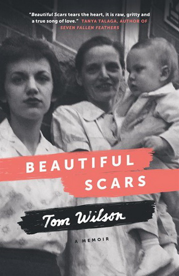 Beautiful Scars - TOM WILSON