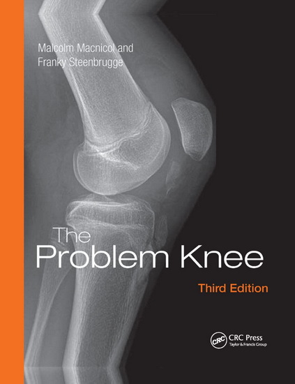 The Problem Knee 3rd ed. - MALCOLM F MACNICOL - FRANKY STEENBRUGGE