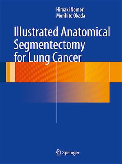 Illustrated Anatomical Segmentectomy for Lung Cancer - HIROAKI NOMORI - MORIHITO OKADA