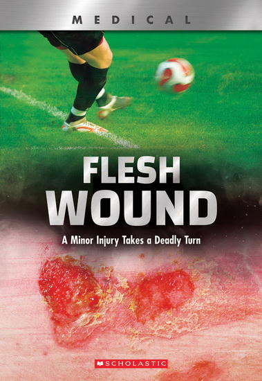Flesh Wound (XBooks) (Library Edition) - SHEA PHILLIPS