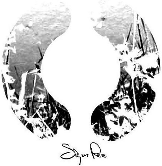 () (Vinyle - Réédition - 2Vinyl) - SIGUR RÓS