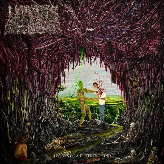Lesions Of A Different Kind - UNDEATH