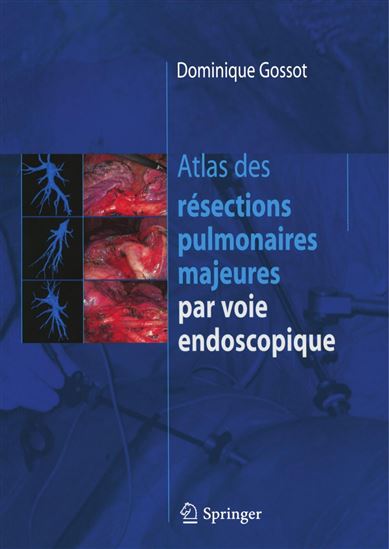 Atlas des résections pulmonaires majeures par voie endoscopique - DOMINIQUE GOSSOT