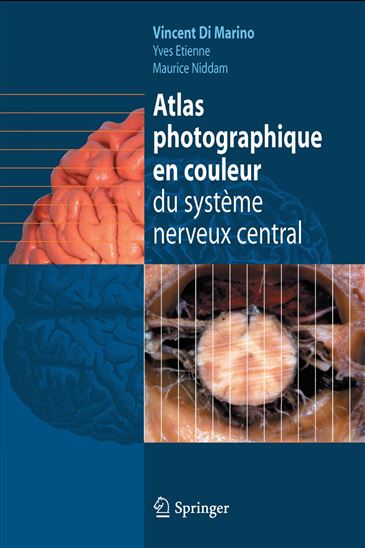 Atlas photographique en couleur du système nerveux central - VINCENT DI MARINO - YVES ETIENNE - MAURICE NIDDAM