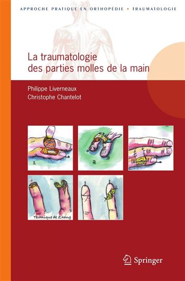 La traumatologie des parties molles de la main - Collectif