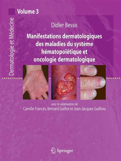 Maladies system hemato... onco... dermat - COLLECTIF
