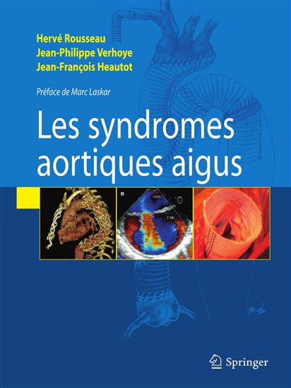 Les syndromes aortiques aigus - JEAN-FRANÇOIS HEAUTOT - HERVÉ ROUSSEAU - JEAN-PHILIPPE VERHOYE