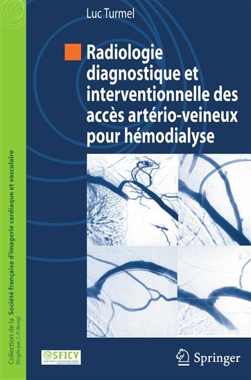 Radiologie diagnostique et interventionnelle des accès artério-veineux pour hémodialyse - JEAN-PAUL BEREGI - LUC TURMEL