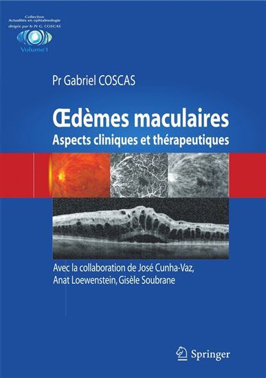 Oedèmes maculaires : aspects cliniques et thérapeutiques - GABRIEL COSCAS