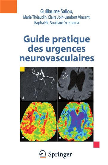 Guide pratique des urgences neurovasculaires - Collectif