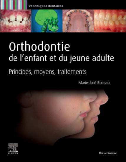 Orthodontie de l'enfant et du jeune adulte : principes, moyens, traitements - MARIE-JOSÉ BOILEAU