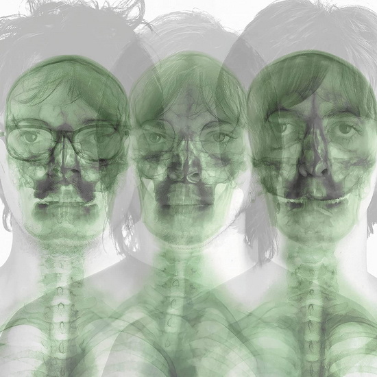 Supergrass (2 CD) - SUPERGRASS