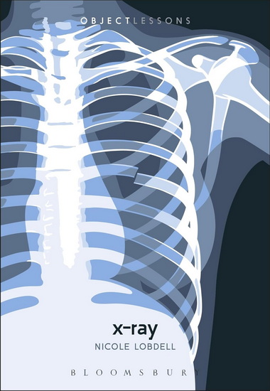 X-Ray - NICOLE LOBDELL