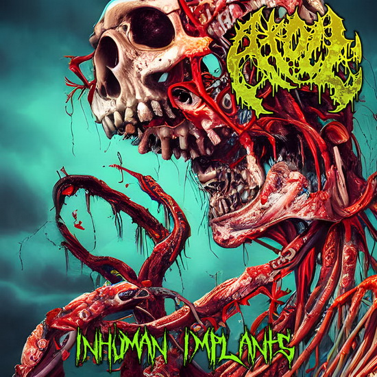 Inhuman Implants - ATOLL