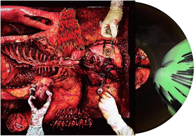 Manual Manic Procedures (Vinyle - Nightmare Frost) - 200 STAB WOUNDS