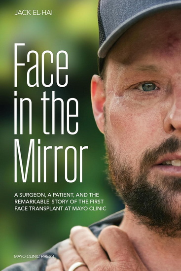 Face in the Mirror: A Surgeon, a Patient, and the Remarkable Story of the First Face Transplant at Mayo Clinic - JACK EL-HAI