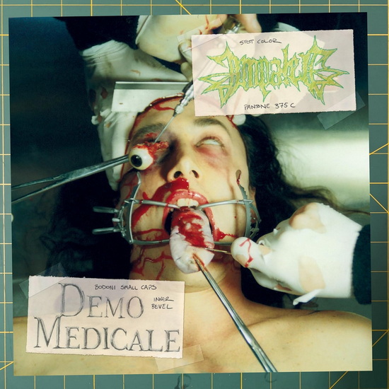 Demo Medicale - IMPALED