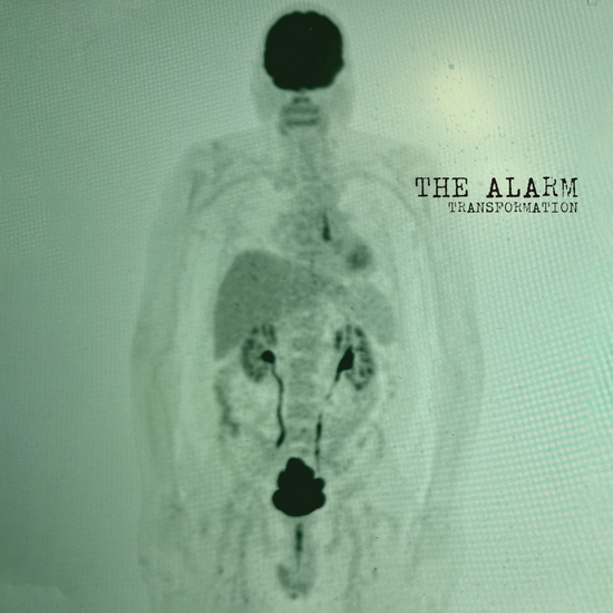Transformation (Vinyle Vert) - THE ALARM