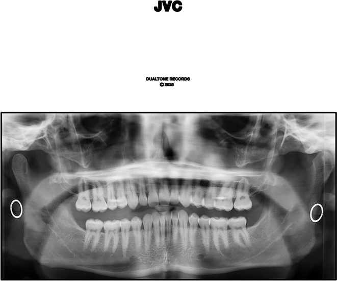 JVC - JACK VAN CLEAF