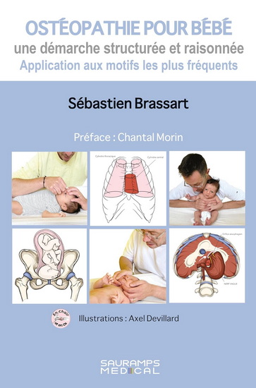 Ostéopathie pour bébé : une démarche structurée et raisonnée : application aux motifs les plus fréquents - SÉBASTIEN BRASSART - AXEL DEVILLARD