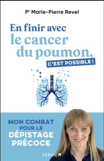 En finir avec le cancer du poumon, c&#39;est possible ! - MARIE-PIERRE REVEL