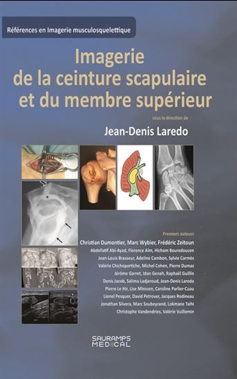Imagerie de la ceinture scapulaire et du membre supérieur - COLLECTIF