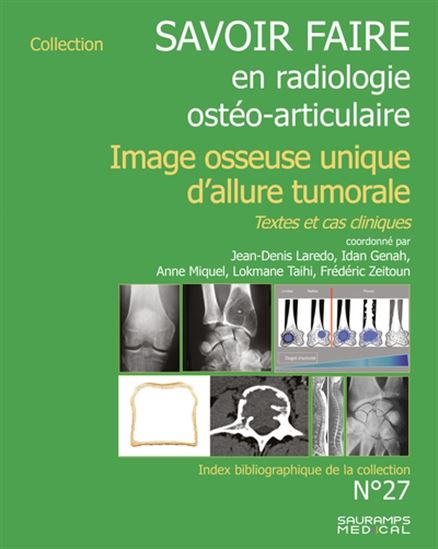 Image osseuse unique d&#39;allure tumorale : textes et cas cliniques #27 - COLLECTIF